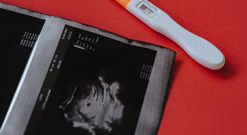 ¿Cuándo se realiza la primera ecografía del embarazo?