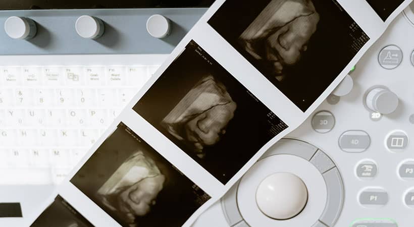 Tipos de ecografías durante el embarazo