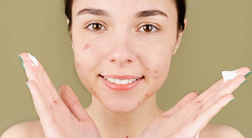 10 mejores cremas para el tratamiento de acné juvenil